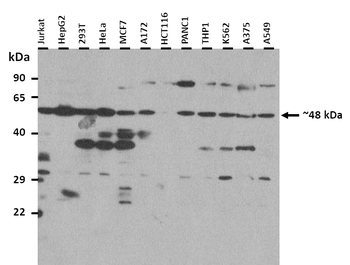 KCNJ8 Rabbit Polyclonal Antibody