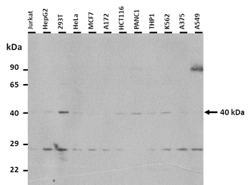 KCNJ8 Rabbit Polyclonal Antibody