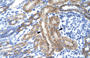 KCNA10 Rabbit Polyclonal Antibody