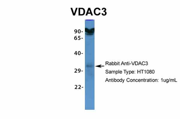 VDAC3 Rabbit Polyclonal Antibody