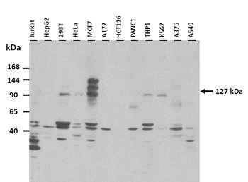 TRPA1 Rabbit Polyclonal Antibody