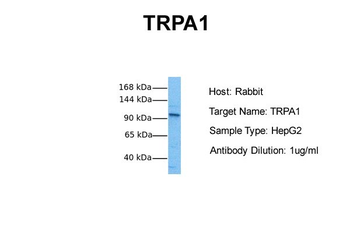 TRPA1 Rabbit Polyclonal Antibody