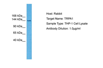TRPA1 Rabbit Polyclonal Antibody