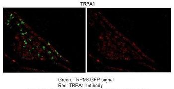 TRPA1 Rabbit Polyclonal Antibody