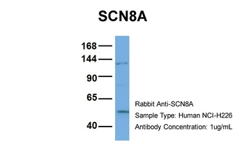 SCN8A Rabbit Polyclonal Antibody