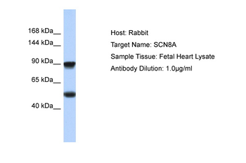 SCN8A Rabbit Polyclonal Antibody