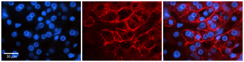 SCN8A Rabbit Polyclonal Antibody