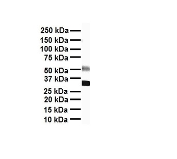 SCN8A Rabbit Polyclonal Antibody