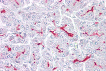 TRPM5 Rabbit Polyclonal Antibody