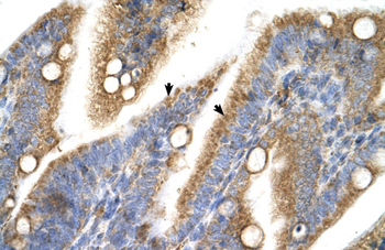 TRPM5 Rabbit Polyclonal Antibody