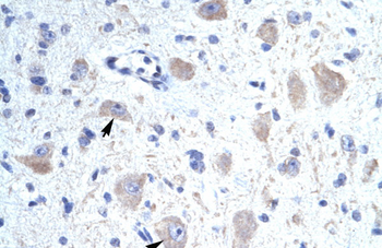 KCNIP1 Rabbit Polyclonal Antibody