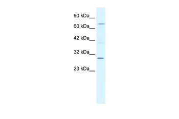 KCNIP1 Rabbit Polyclonal Antibody