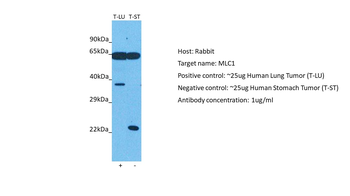 MLC1 Rabbit Polyclonal Antibody