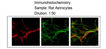 MLC1 Rabbit Polyclonal Antibody