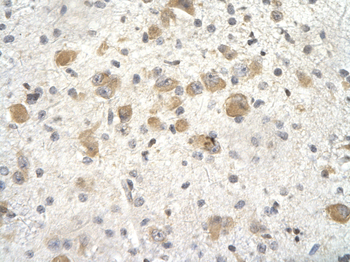 KCTD3 Rabbit Polyclonal Antibody