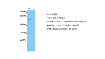 P2RX2 Rabbit Polyclonal Antibody