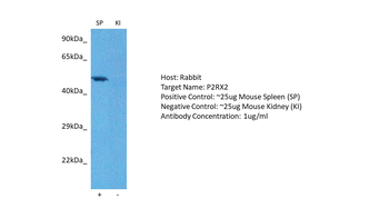 P2RX2 Rabbit Polyclonal Antibody