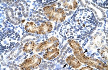 P2RX2 Rabbit Polyclonal Antibody