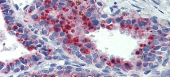KCNK9 Rabbit Polyclonal Antibody