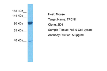 TPCN1 Rabbit Polyclonal Antibody