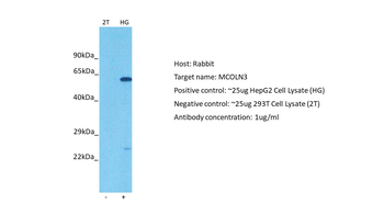 MCOLN3 Rabbit Polyclonal Antibody