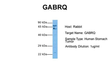 GABRQ Rabbit Polyclonal Antibody