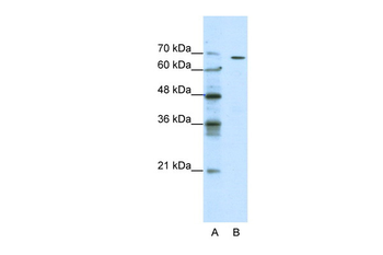 GABRQ Rabbit Polyclonal Antibody
