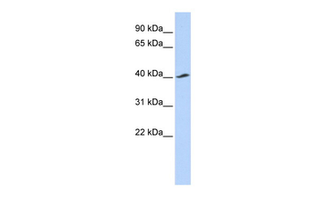KCNJ16 Rabbit Polyclonal Antibody