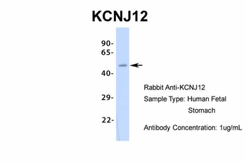 KCNJ12 Rabbit Polyclonal Antibody