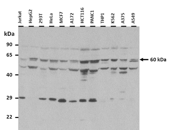 KCNK10 Rabbit Polyclonal Antibody