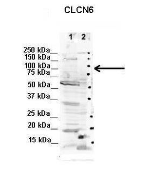 CLCN6 Rabbit Polyclonal Antibody