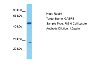 GABRE Rabbit Polyclonal Antibody