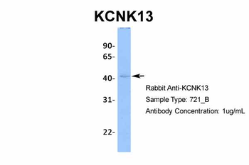 KCNK13 Rabbit Polyclonal Antibody