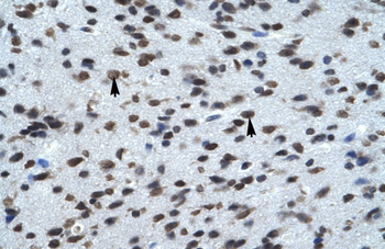 KCNK13 Rabbit Polyclonal Antibody