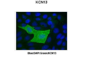 KCNK13 Rabbit Polyclonal Antibody