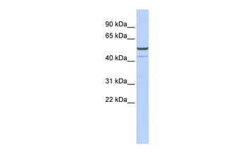 KCNK12 Rabbit Polyclonal Antibody