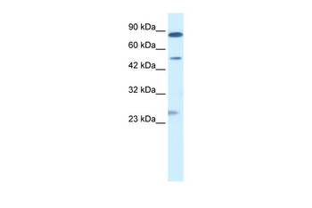 CLIC6 Rabbit Polyclonal Antibody