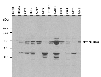 TRPV4 Rabbit Polyclonal Antibody