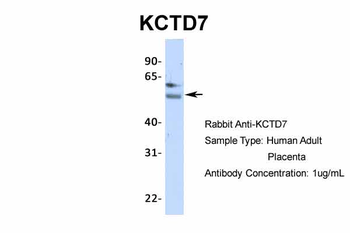 KCTD7 Rabbit Polyclonal Antibody