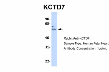 KCTD7 Rabbit Polyclonal Antibody