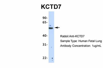 KCTD7 Rabbit Polyclonal Antibody