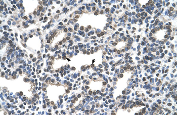 KCTD6 Rabbit Polyclonal Antibody
