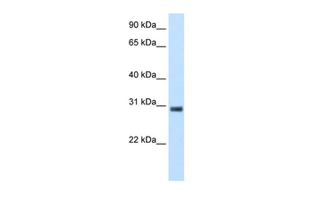 KCTD6 Rabbit Polyclonal Antibody