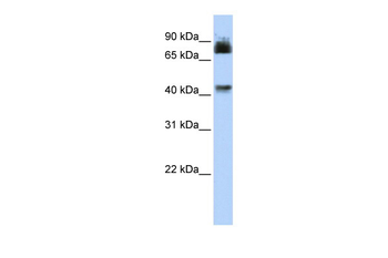 P2RX2 Rabbit Polyclonal Antibody