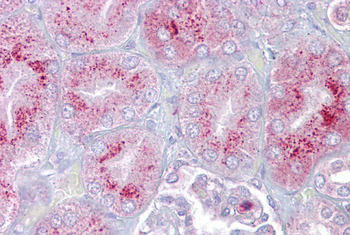 P2RX2 Rabbit Polyclonal Antibody