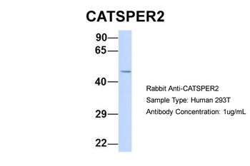 CATSPER2 Rabbit Polyclonal Antibody