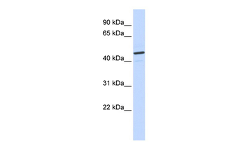 CATSPER2 Rabbit Polyclonal Antibody
