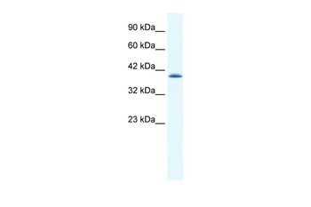 CATSPER2 Rabbit Polyclonal Antibody