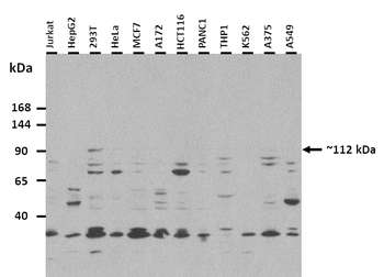 KCNH5 Rabbit Polyclonal Antibody