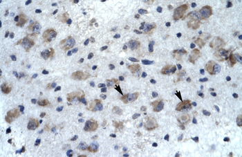 KCNH5 Rabbit Polyclonal Antibody